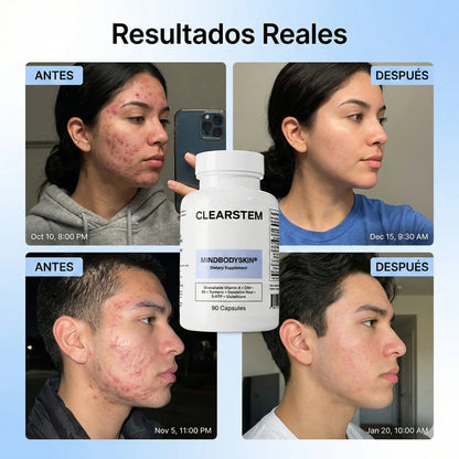 CLEARSTEM MINDBODYSKIN